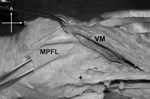 Fig. 10