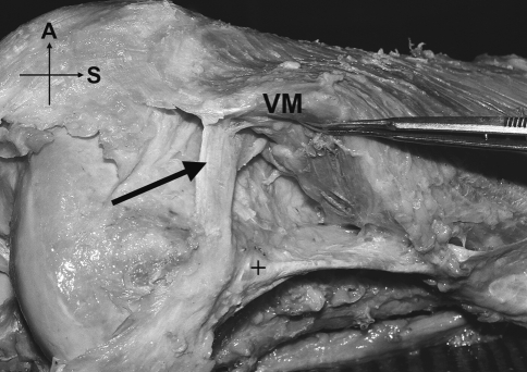 Fig. 11