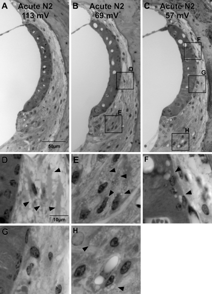 FIG. 11.