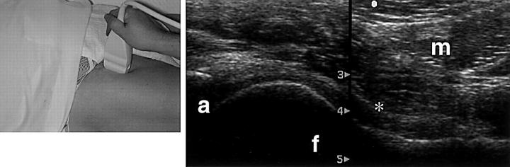 Figure 11  