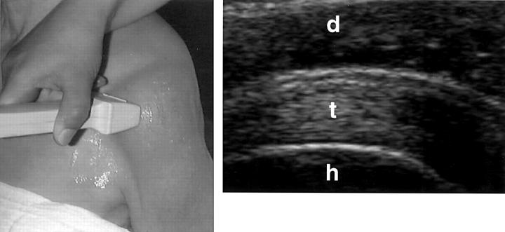 Figure 2  