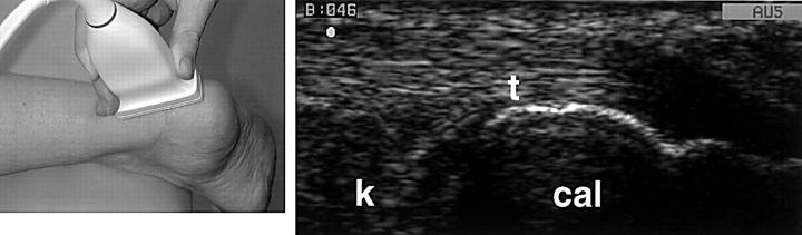 Figure 14  