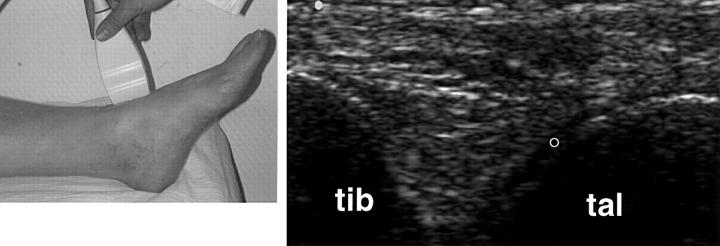 Figure 13  