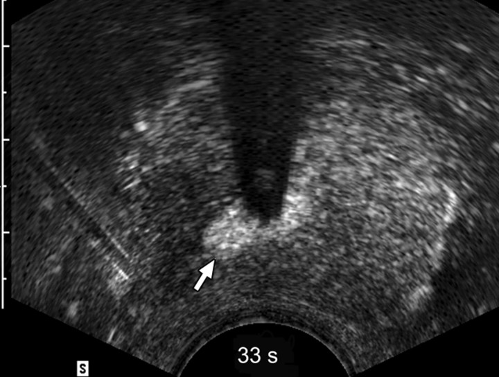 Figure 2b: