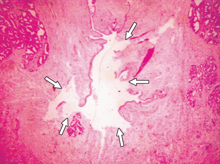 Figure 3c: