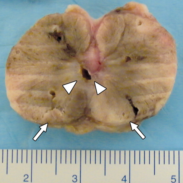 Figure 3b: