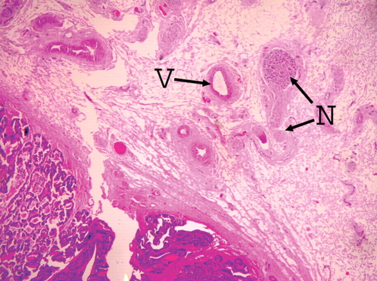 Figure 4d: