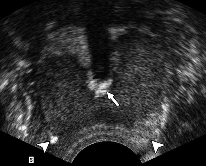 Figure 4a: