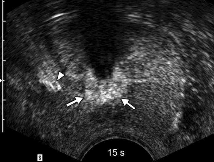 Figure 2a: