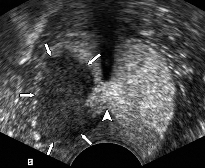 Figure 1c: