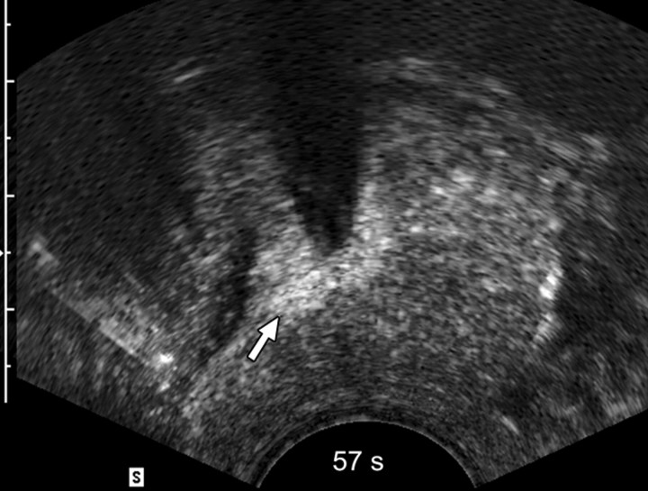 Figure 2c: