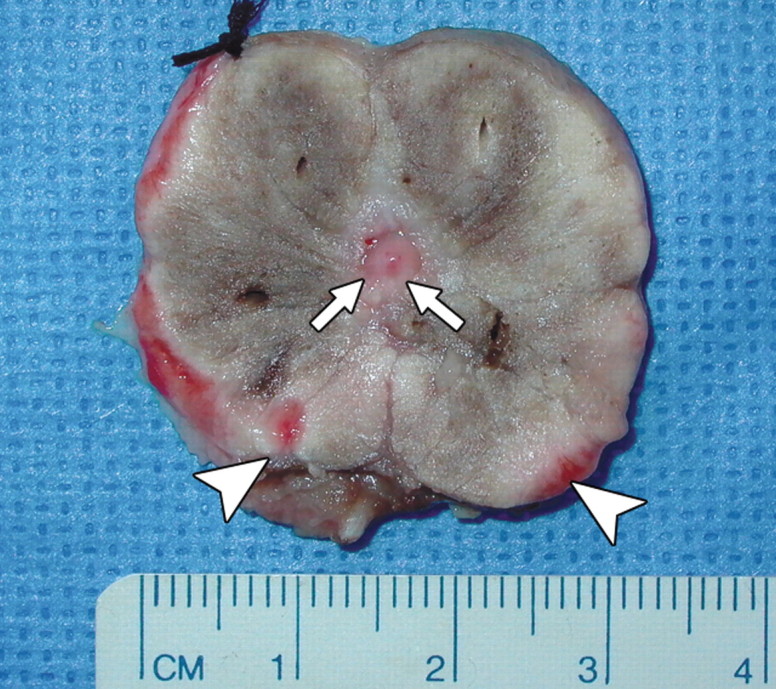 Figure 4b: