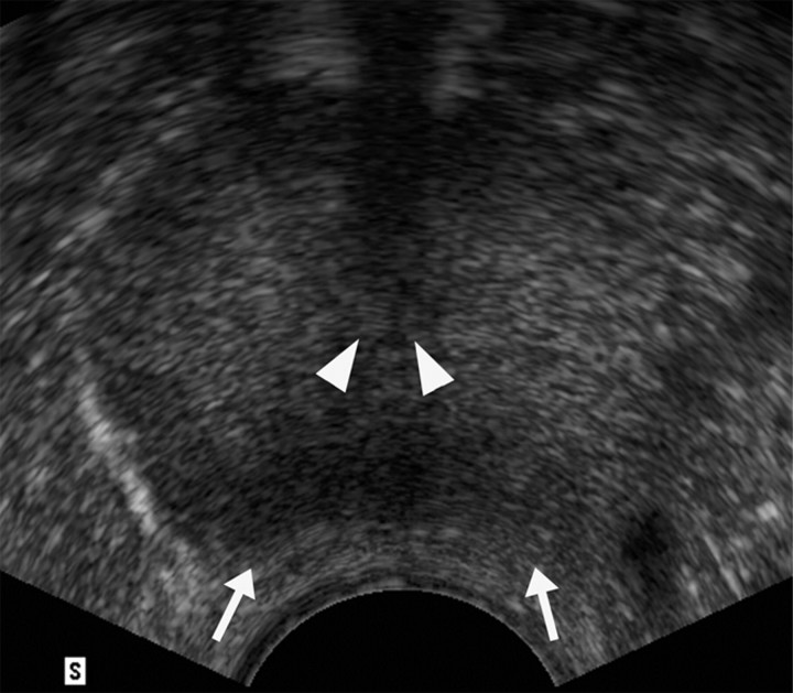 Figure 3a: