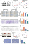 Figure 3. Dysregulation of eIF4A1 af fects the angiogenic activity of gastric cancer cells. (A) Western blotting detected the expression of eIF4A1 in cells after lentivirus infection. (B) Cell Countin...