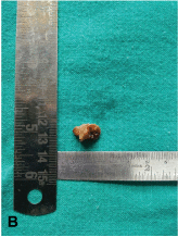 [Table/Fig-2b]: