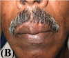 [Table/Fig-4b]: