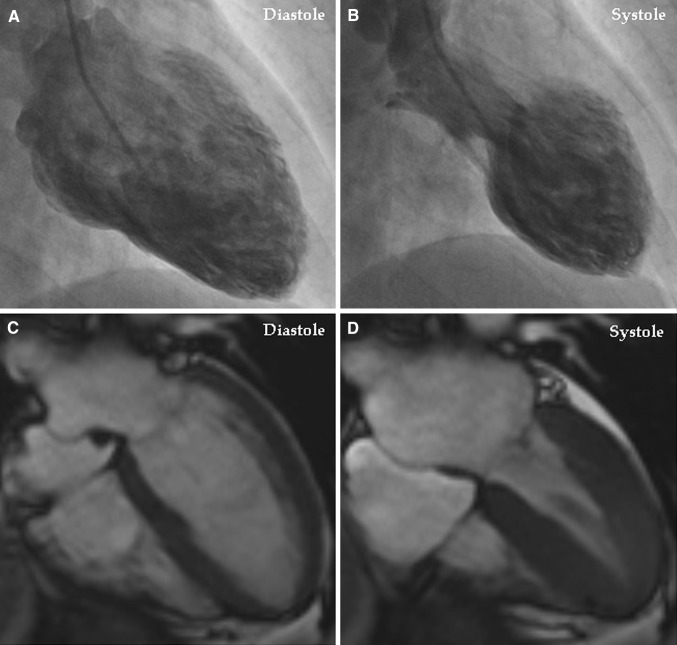 Fig. 1