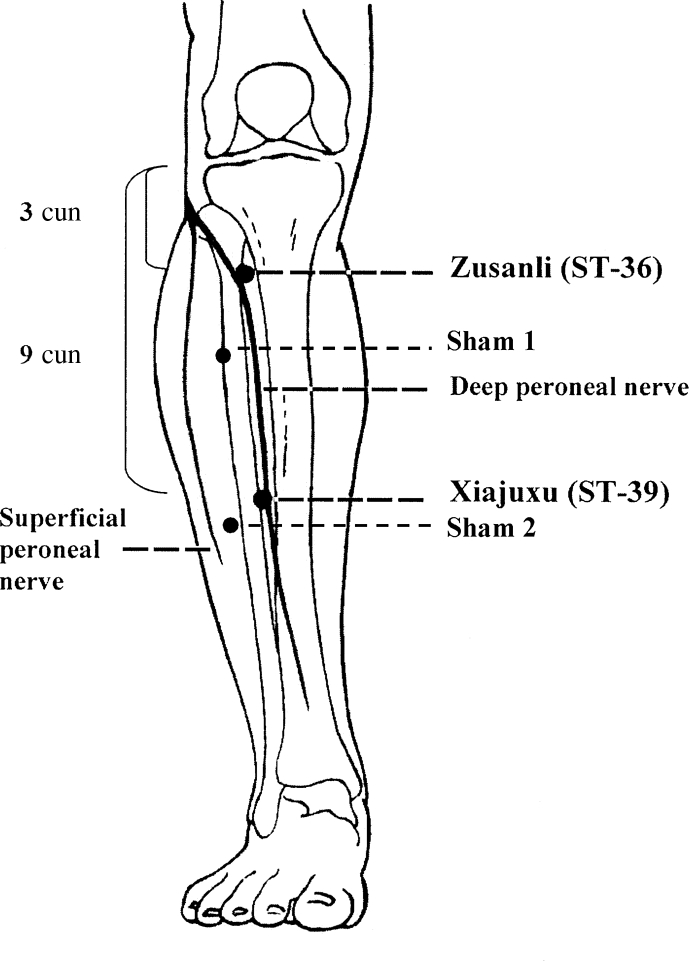 Figure 1