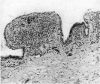 114-2