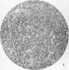 266-1