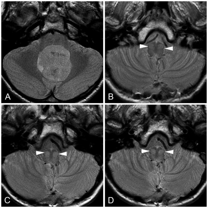 FIG 3