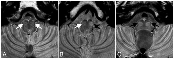 FIG 2