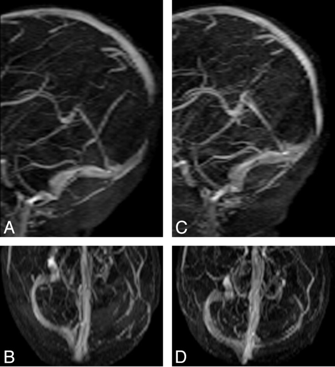 Fig 4.