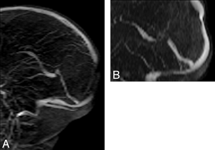 Fig 3.