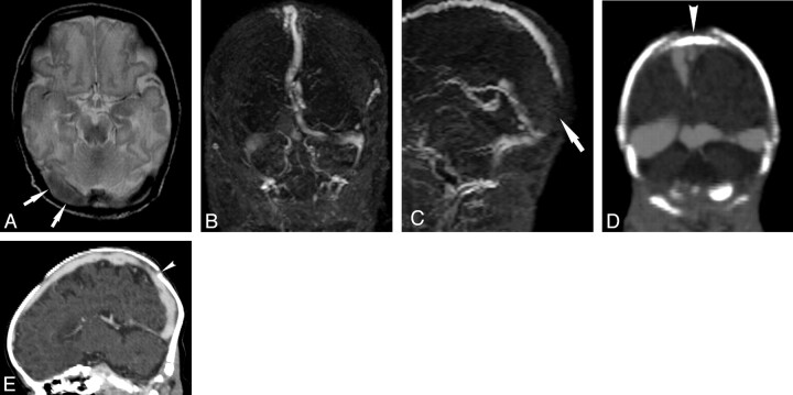 Fig 2.