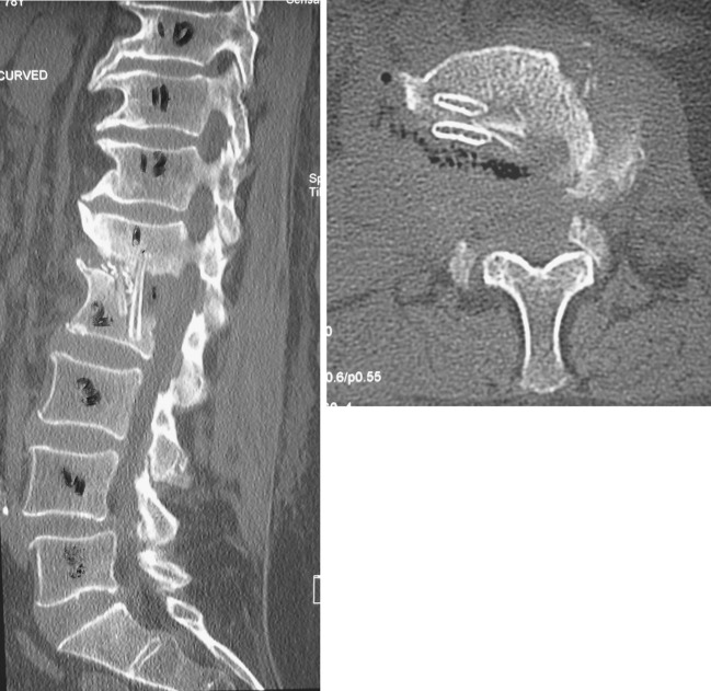 Fig. 7-8