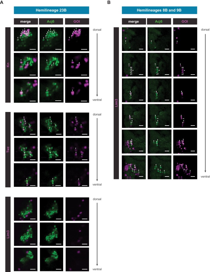 Figure 5—figure supplement 3.