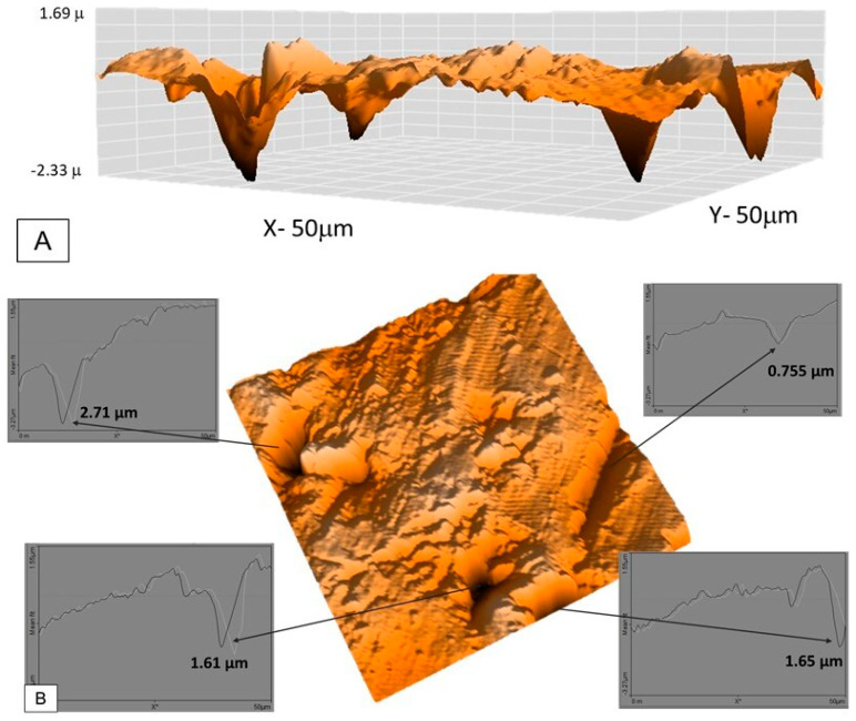 Figure 11