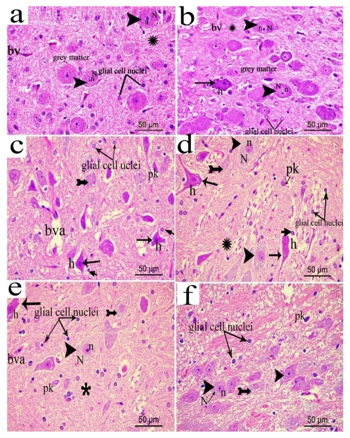 Figure 17