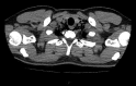 Fig 4.