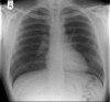 Fig 2.