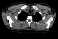 Fig 3.