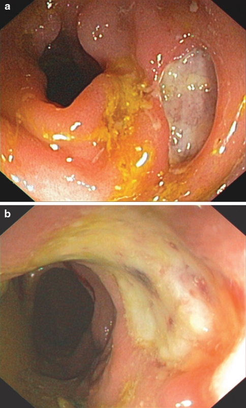 Fig. 1