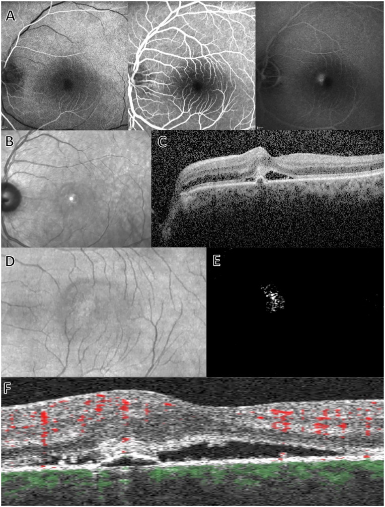 Figure 4.