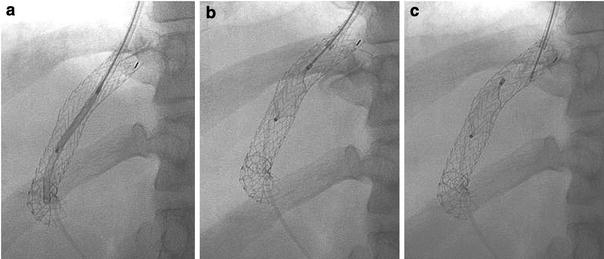 Fig. 3