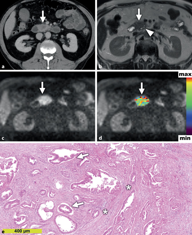 graphic file with name 292_2021_949_Fig3_HTML.jpg
