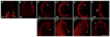 Fig. 12