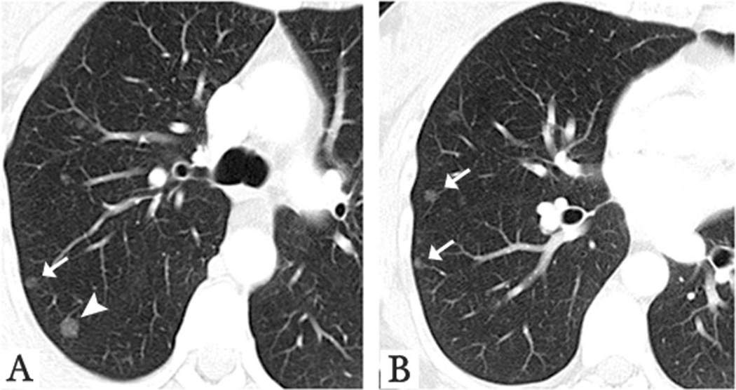 Figure 20