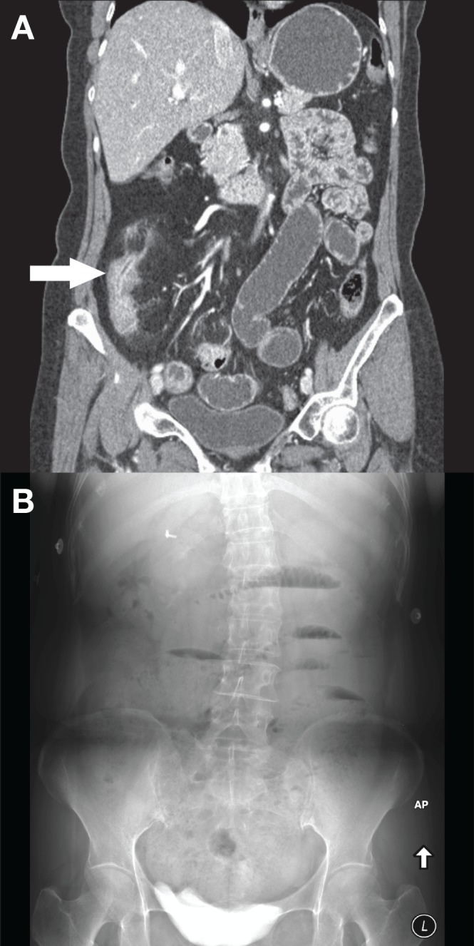 Figure 1)