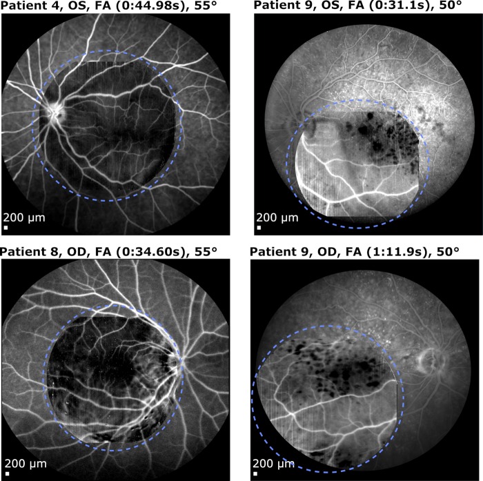 Figure 12