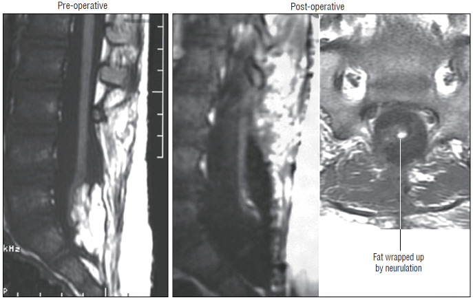 Fig. 35.