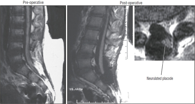 Fig. 34.