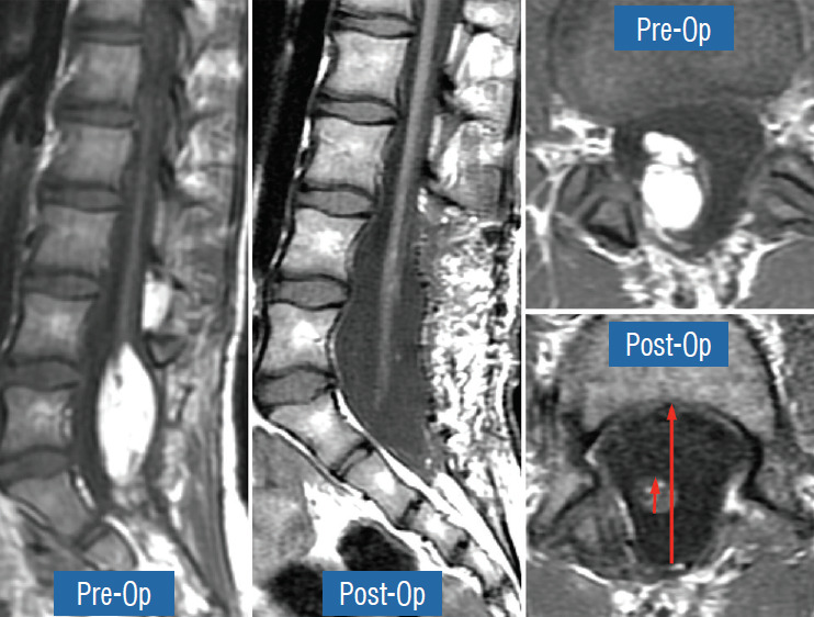 Fig. 41.