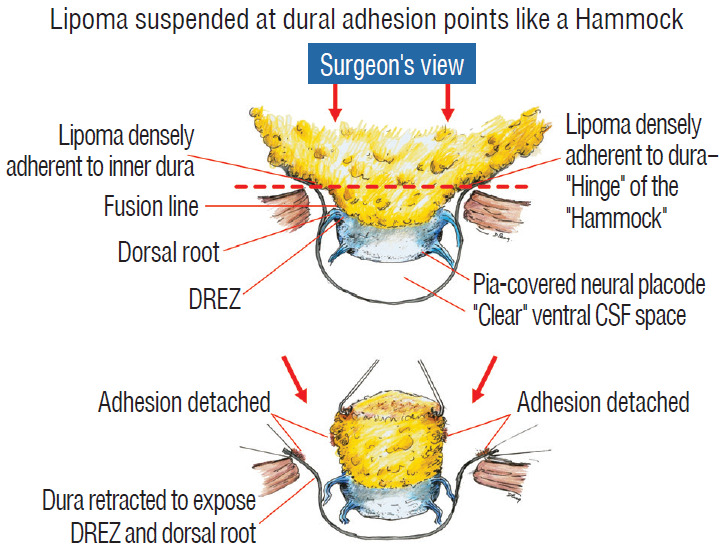 Fig. 11.