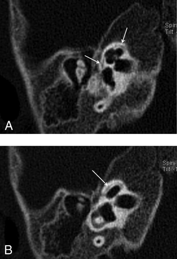 Fig 3.