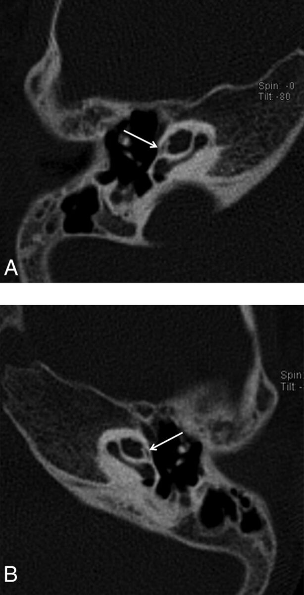 Fig 2.